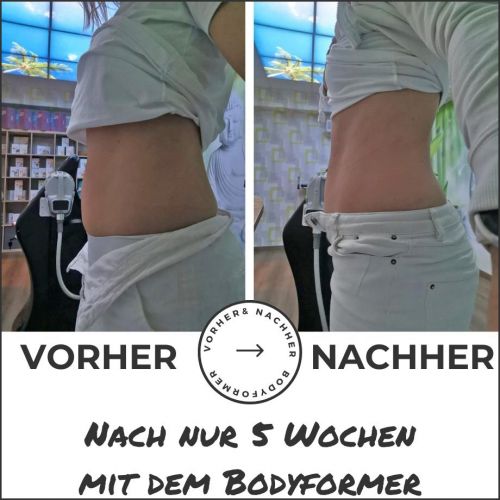 Flacher Bauch mit dem Bodyformer nach nur 5 Wochen